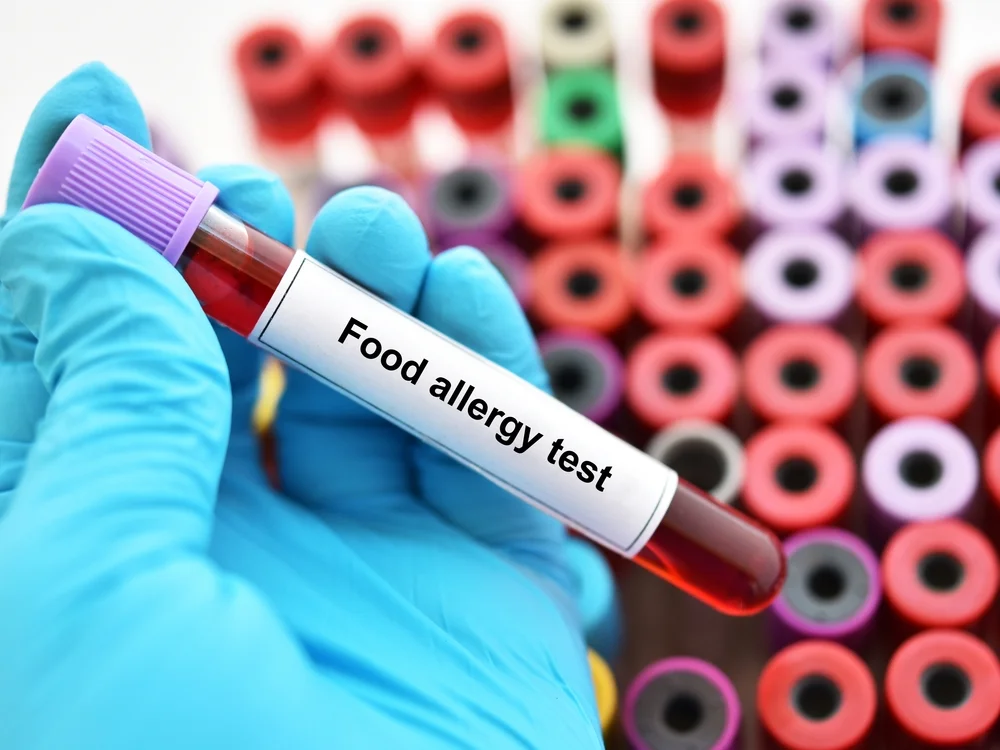 Food Allergy Test