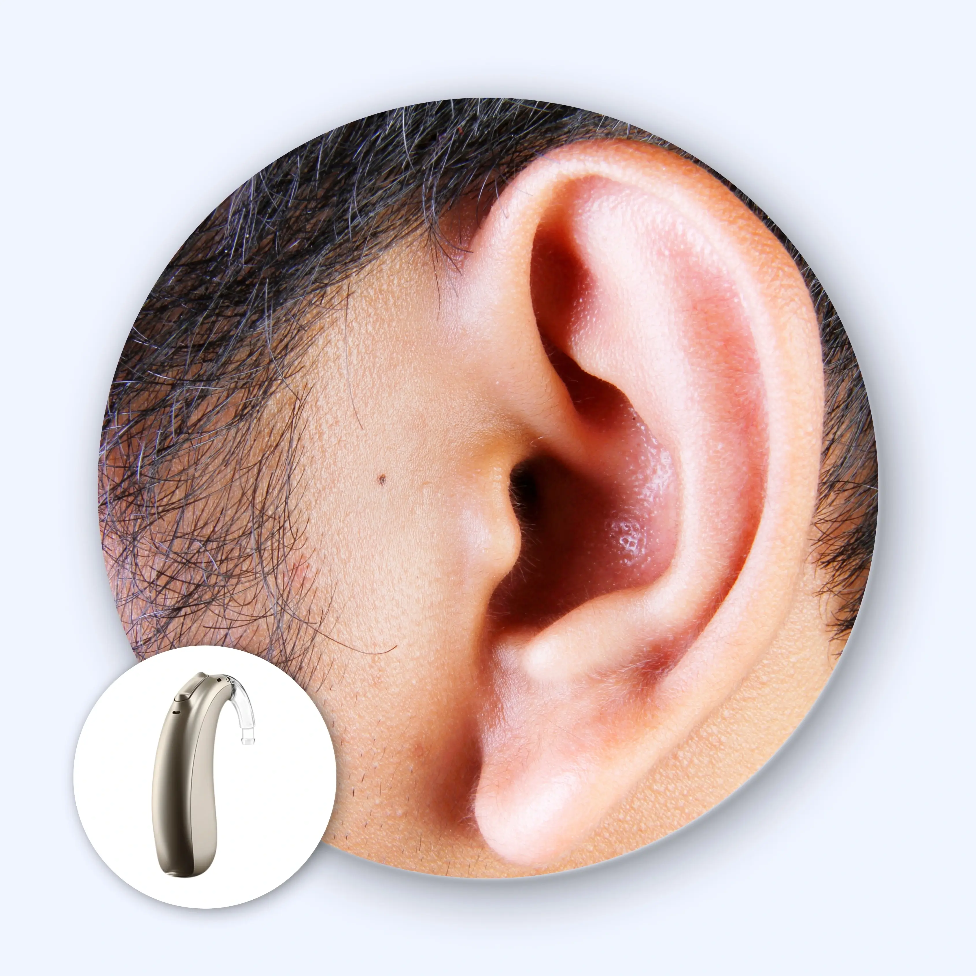 Best BTE Hearing Aids | Powerful & Comfortable Solutions for Hearing Loss.